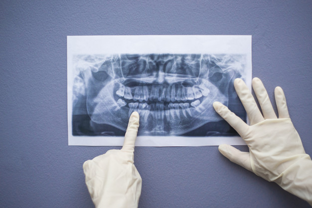 pret radiografie dentara
